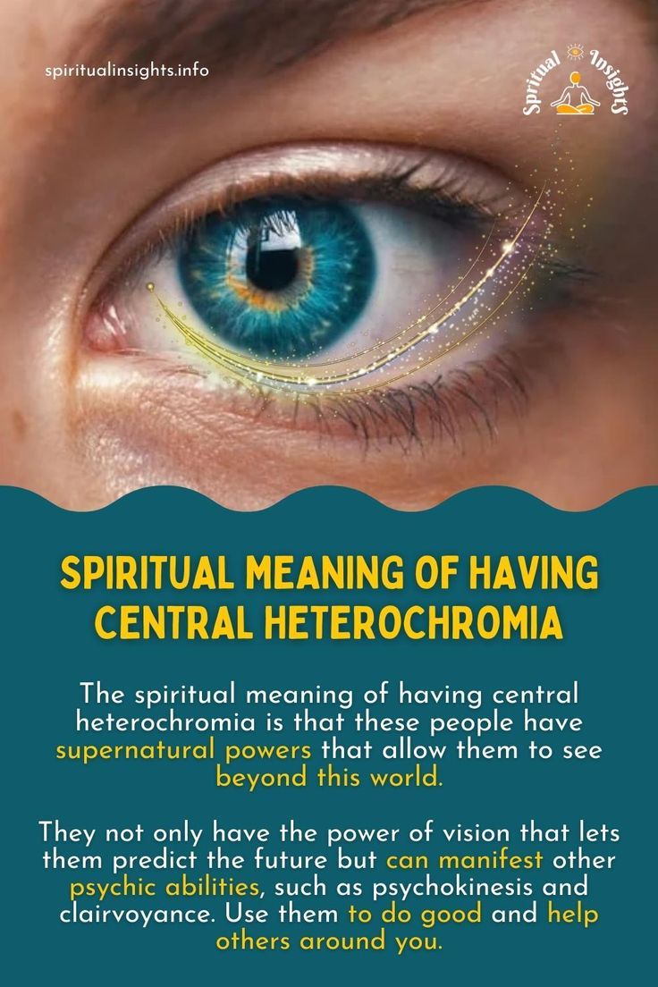 Central Heterochromia Spiritual Meaning