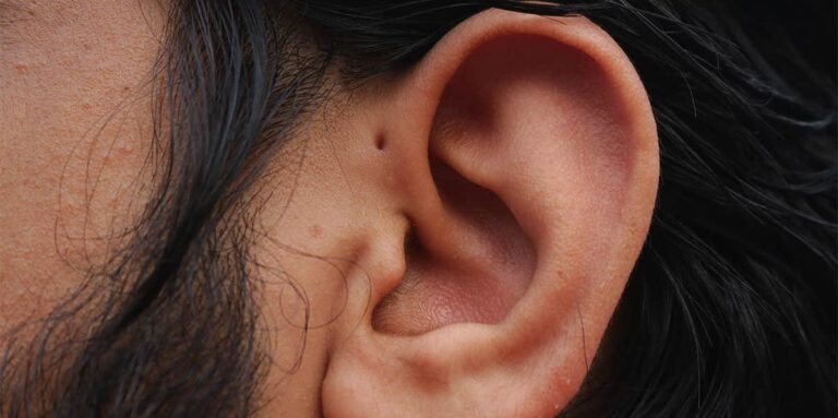Hole in the Ear Spiritual Meaning Preauricular Sinus in Bible