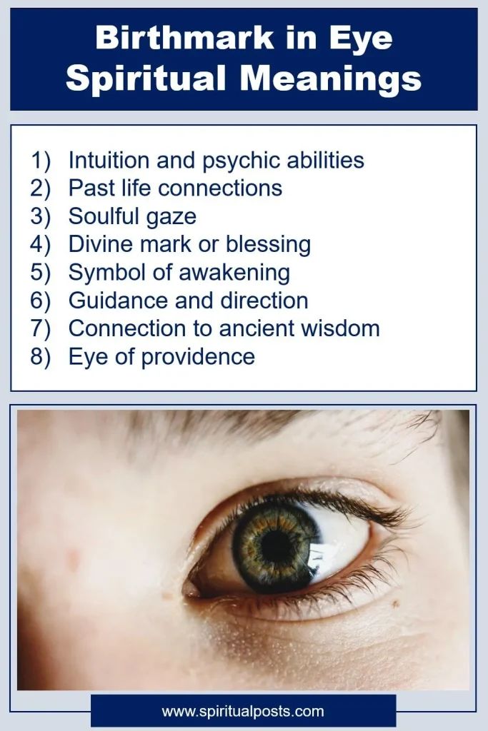 Meaning of Birthmark in Eye