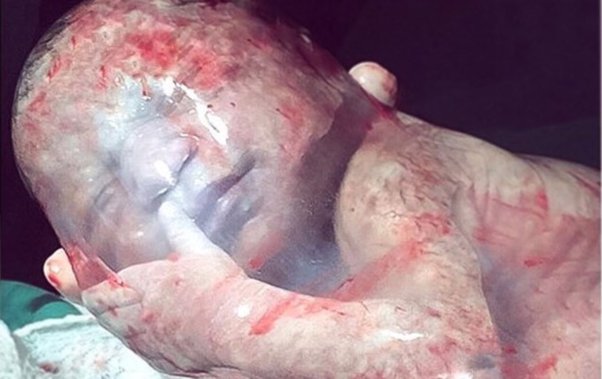 Baby Born With Veil Over Face Spiritual Meaning